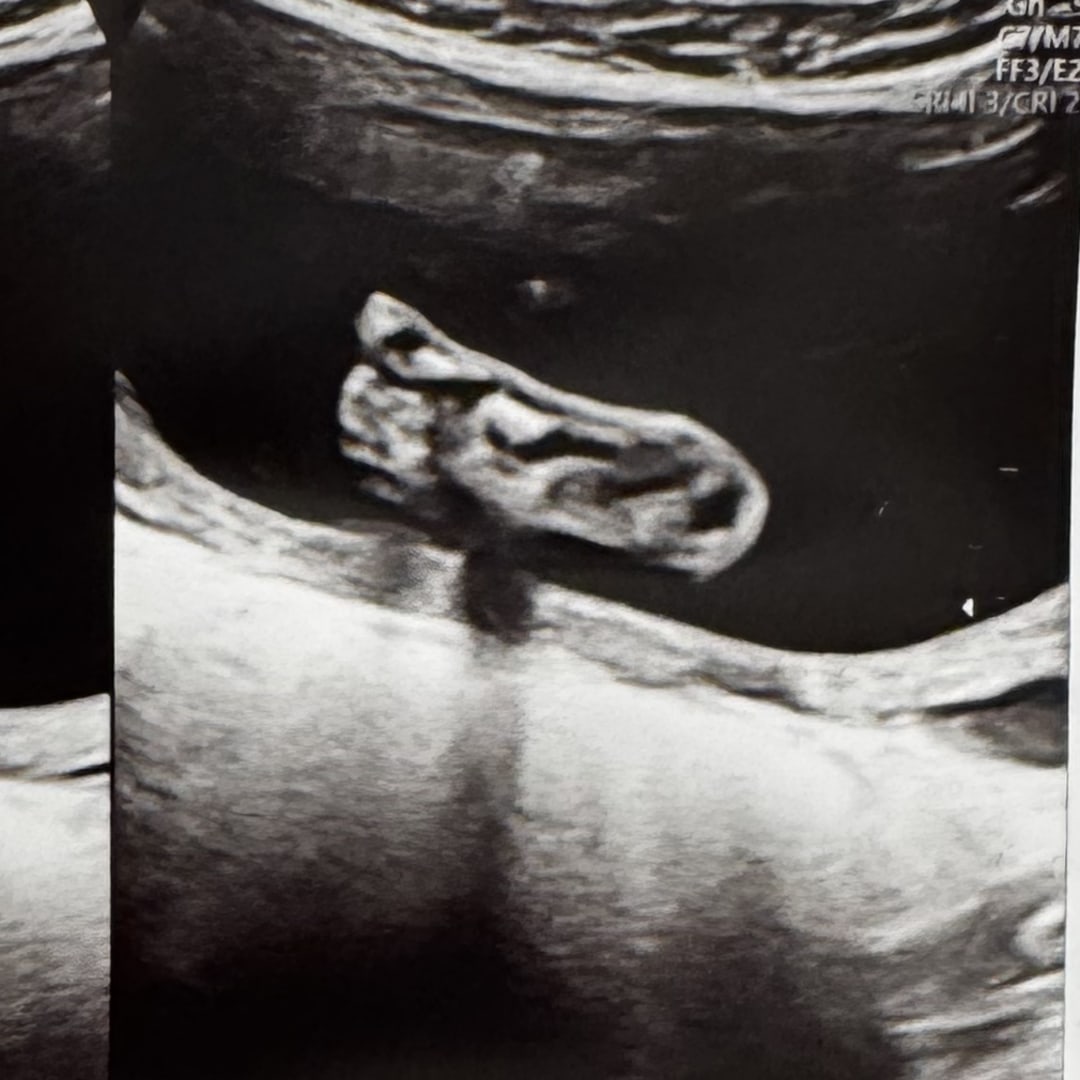 Photo shared by Ebanya (Abby) for their Babylist baby registry.