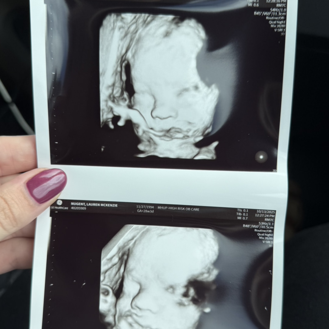 Photo shared by Lauren for their Babylist baby registry.