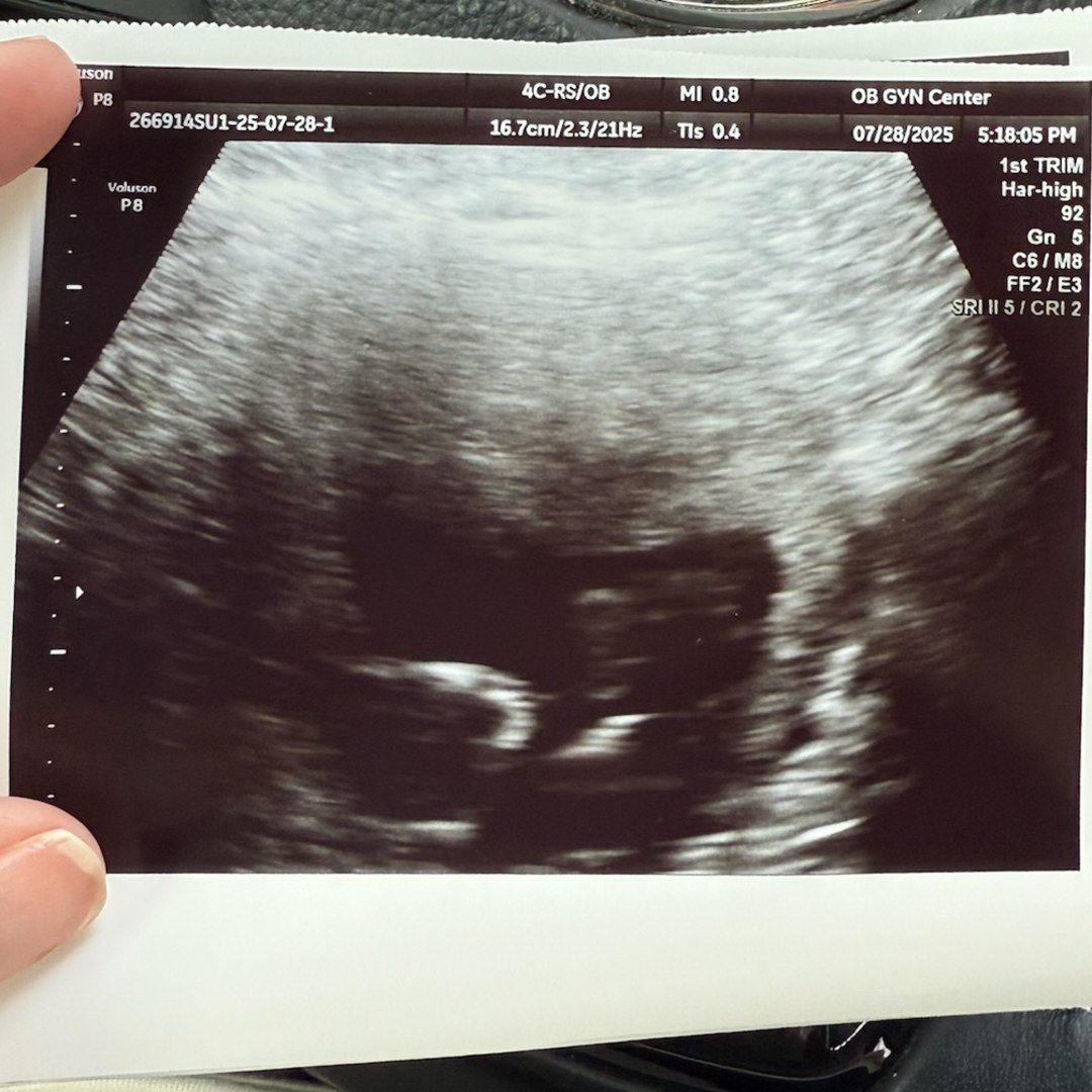 Photo shared by Morgan for their Babylist baby registry.