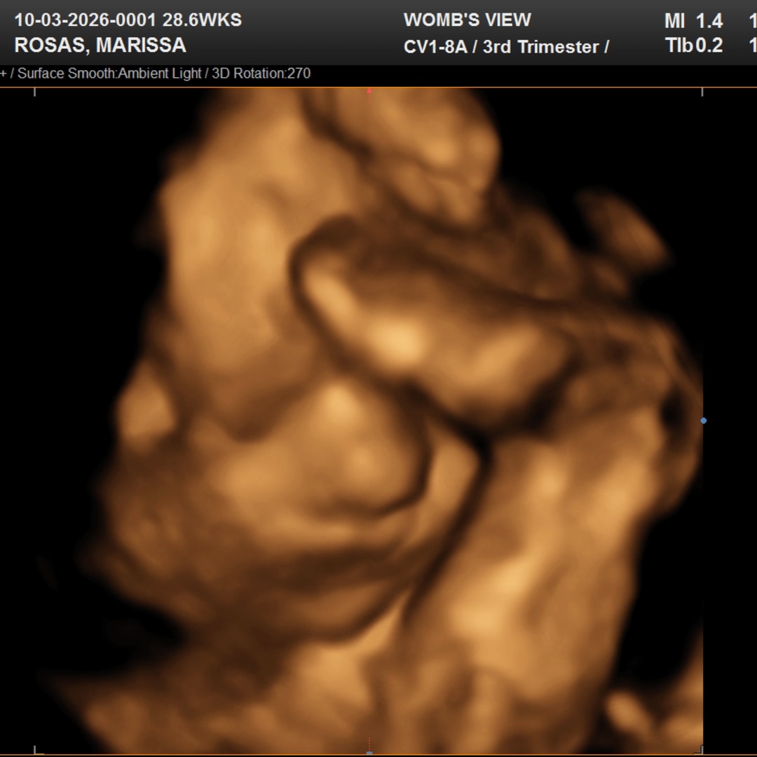 Photo shared by Marissa for their Babylist baby registry.