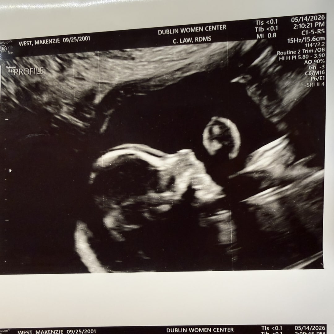 Photo shared by MaKenzie for their Babylist baby registry.