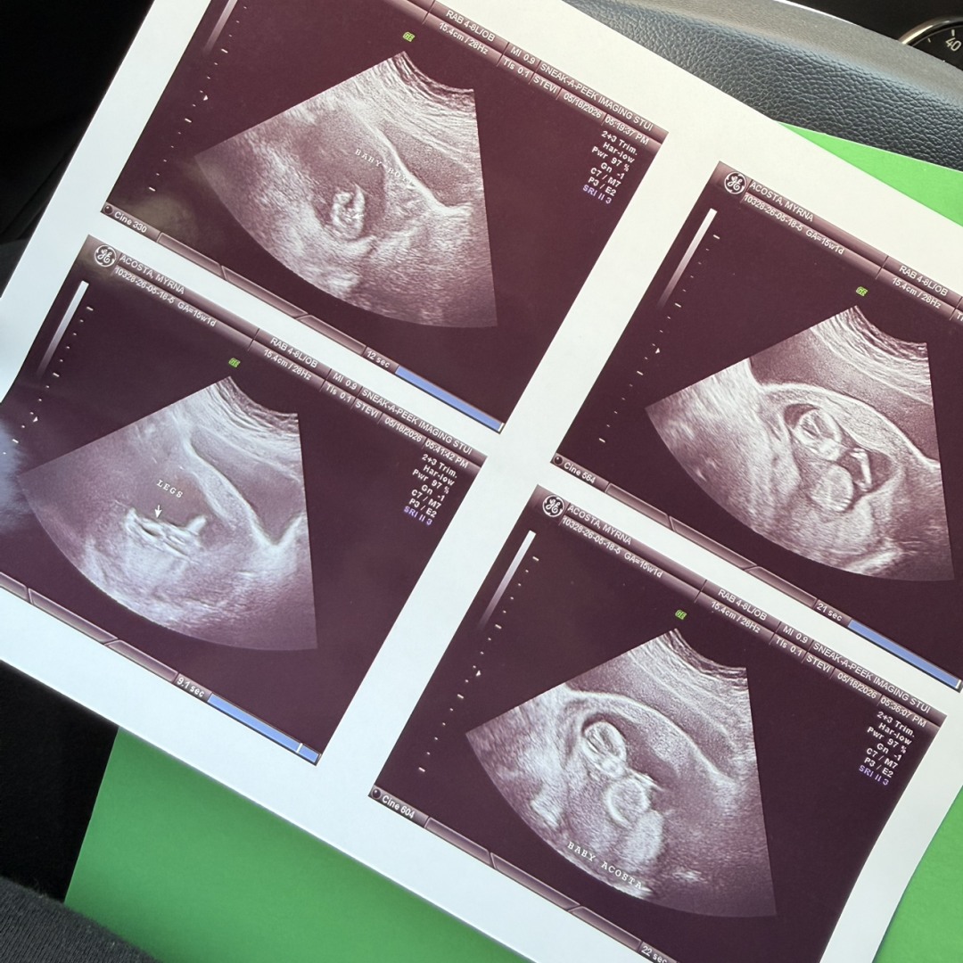 Photo shared by Myrna for their Babylist baby registry.