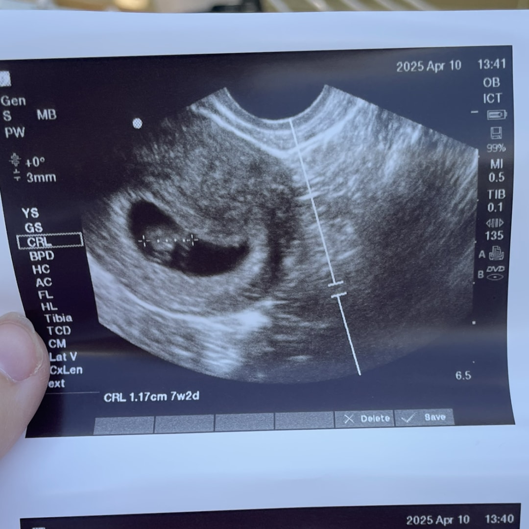 Photo shared by Caroline for their Babylist baby registry.