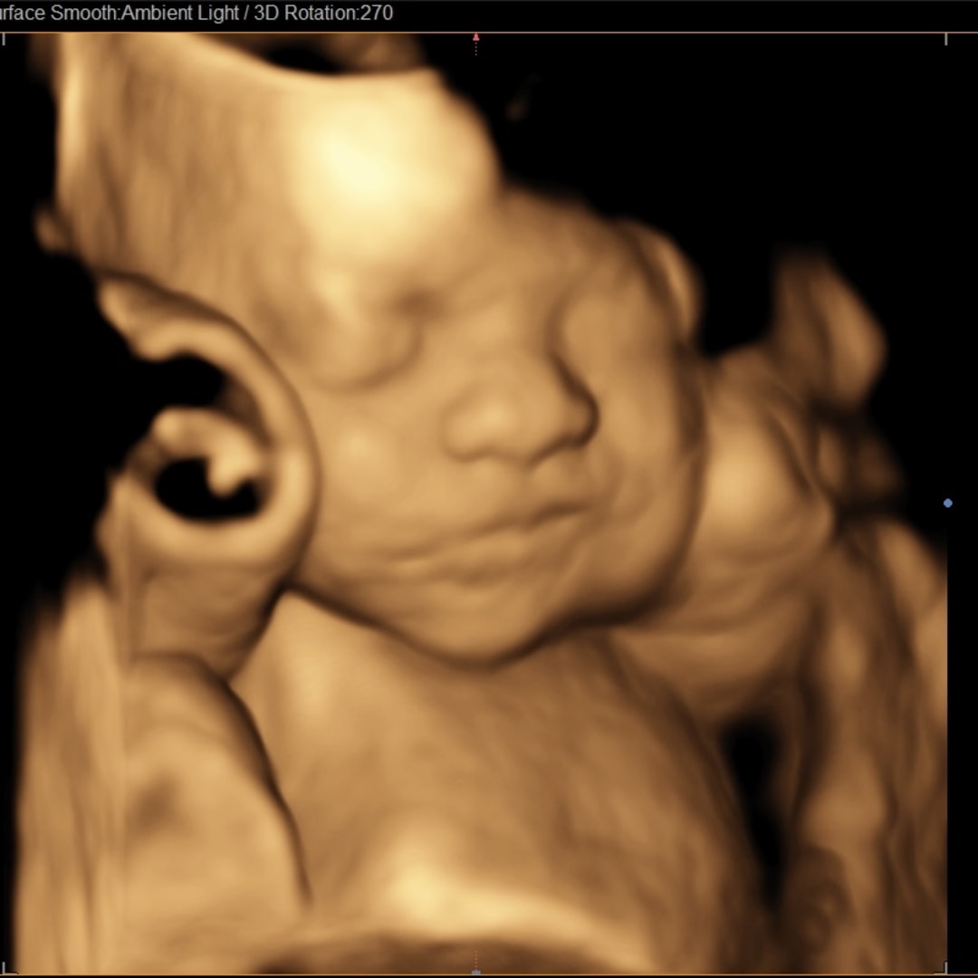 Photo shared by Michelle for their Babylist baby registry.