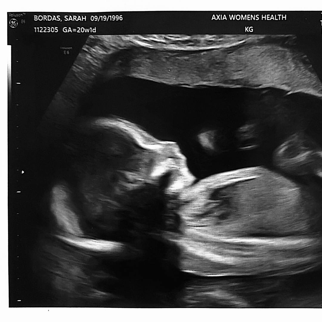 Photo shared by Sarah for their Babylist baby registry.