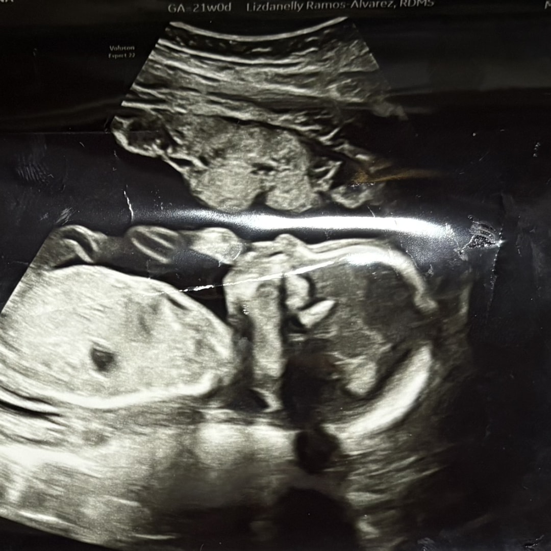 Photo shared by Alina for their Babylist baby registry.