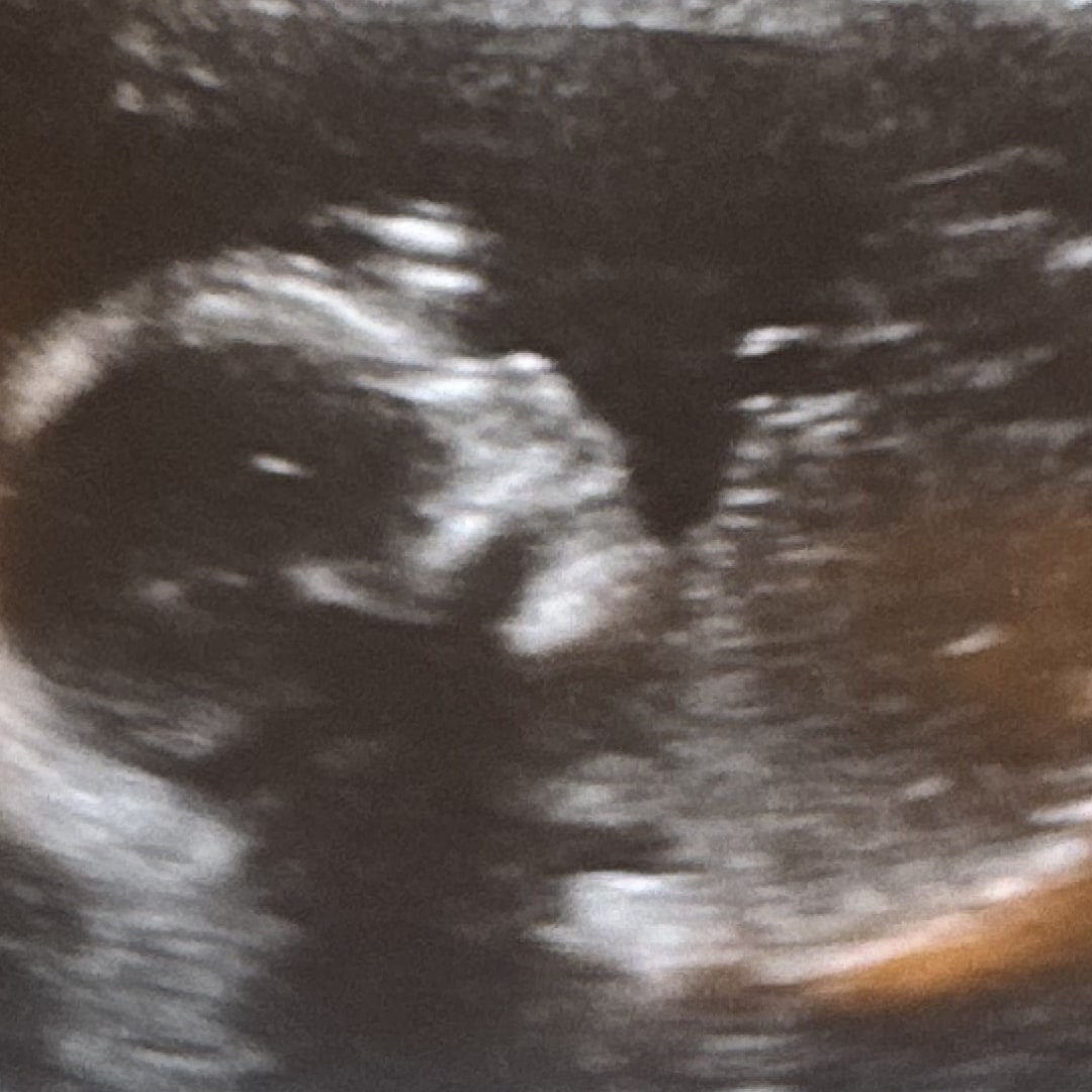 Photo shared by Emma for their Babylist baby registry.