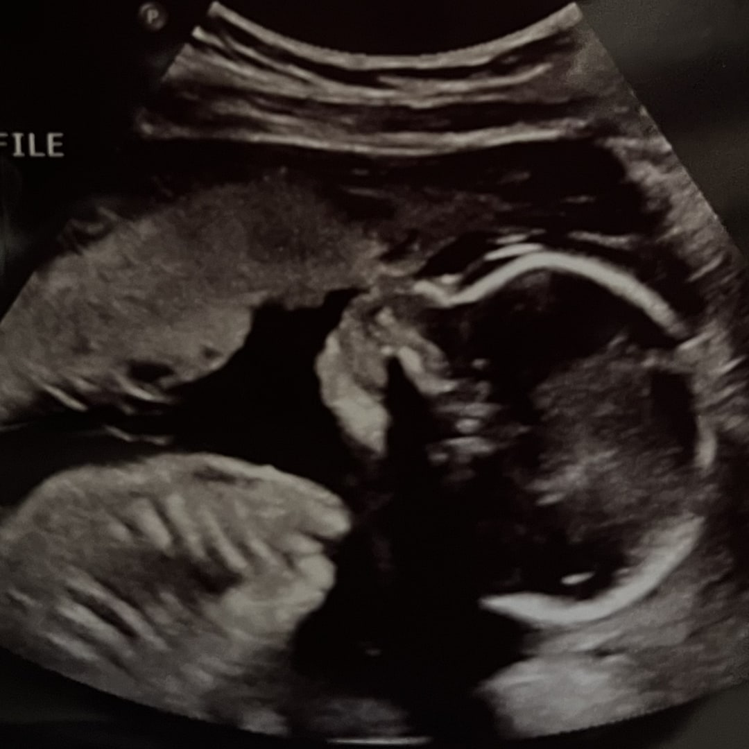 Photo shared by Tristin for their Babylist baby registry.