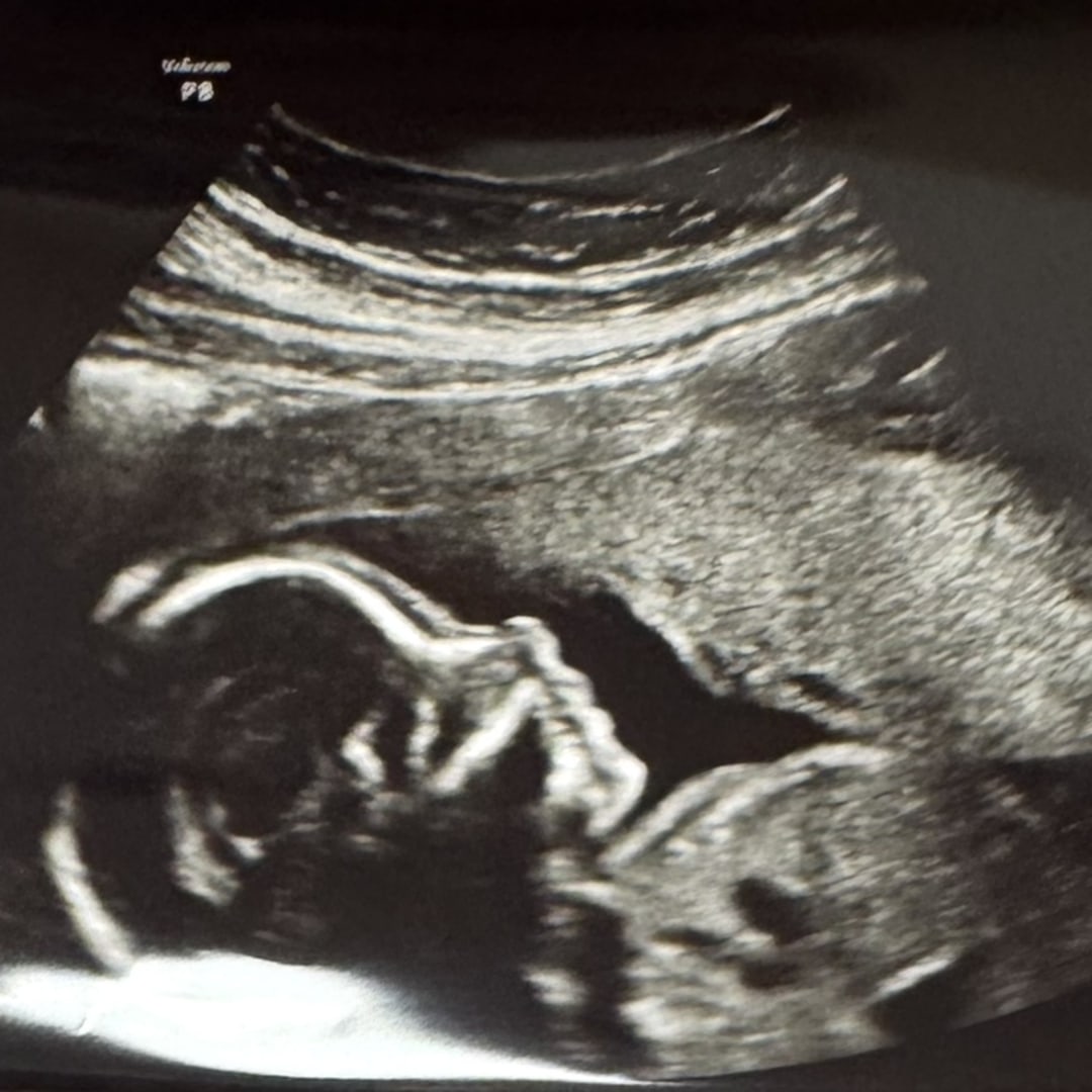 Photo shared by Destiny for their Babylist baby registry.