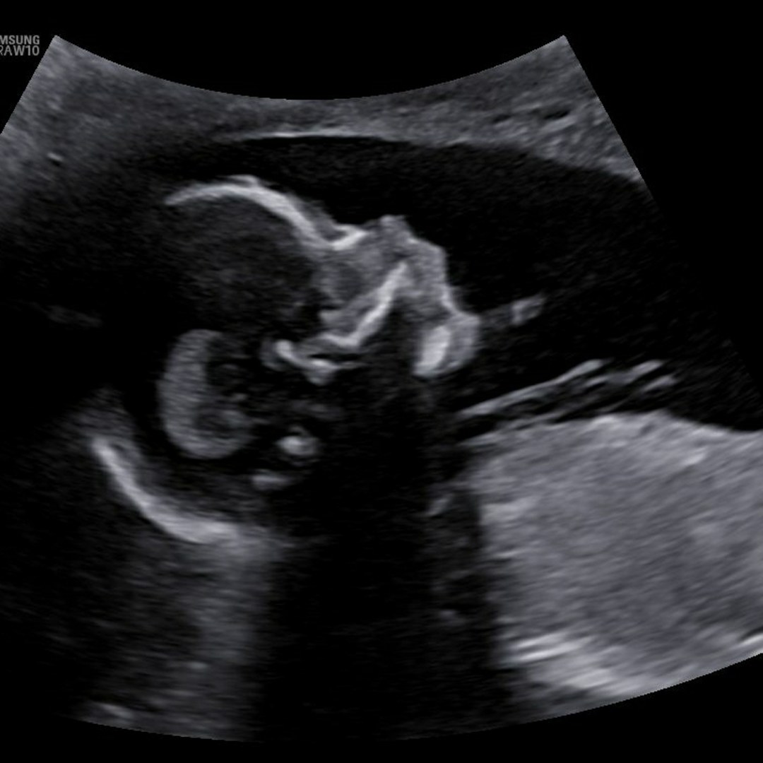 Photo shared by Jessica Bryn for their Babylist baby registry.