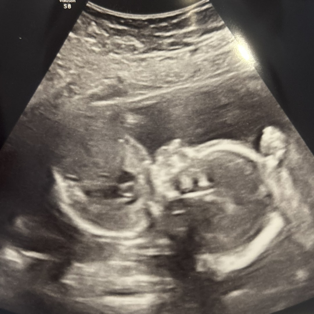 Photo shared by Claire for their Babylist baby registry.