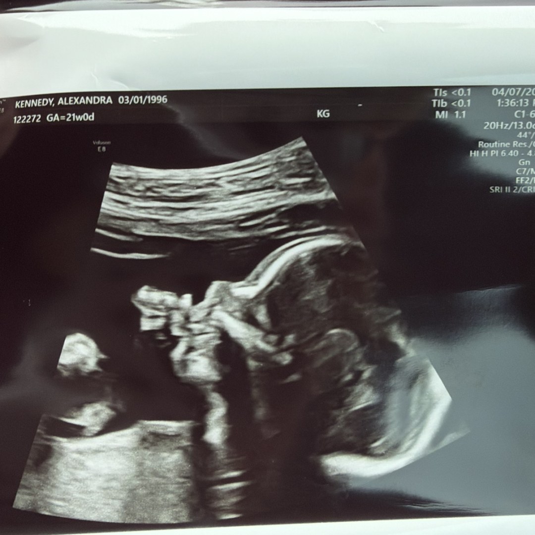 Photo shared by Alexandra for their Babylist baby registry.