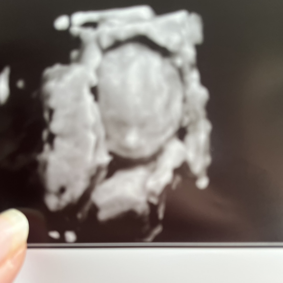 Photo shared by Ashley for their Babylist baby registry.