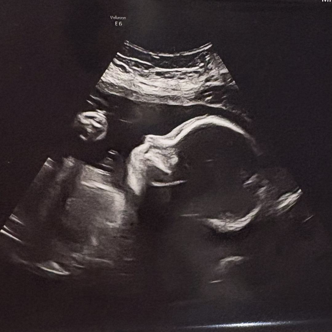 Photo shared by Marisol for their Babylist baby registry.