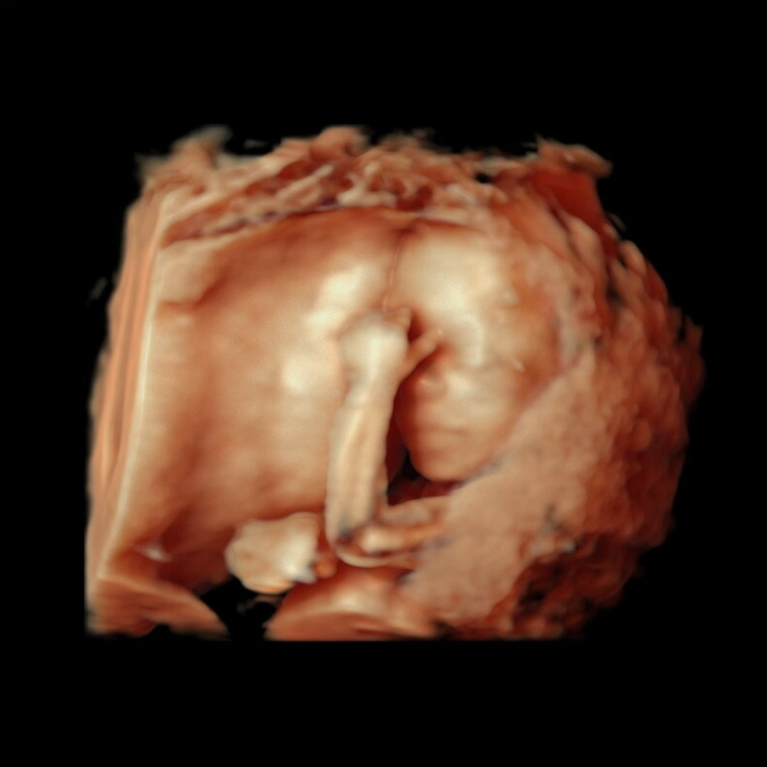 Photo shared by Donte for their Babylist baby registry.