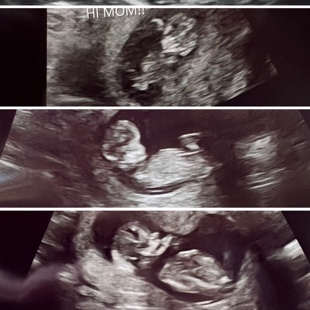 Photo shared by Emalee for their Babylist baby registry.