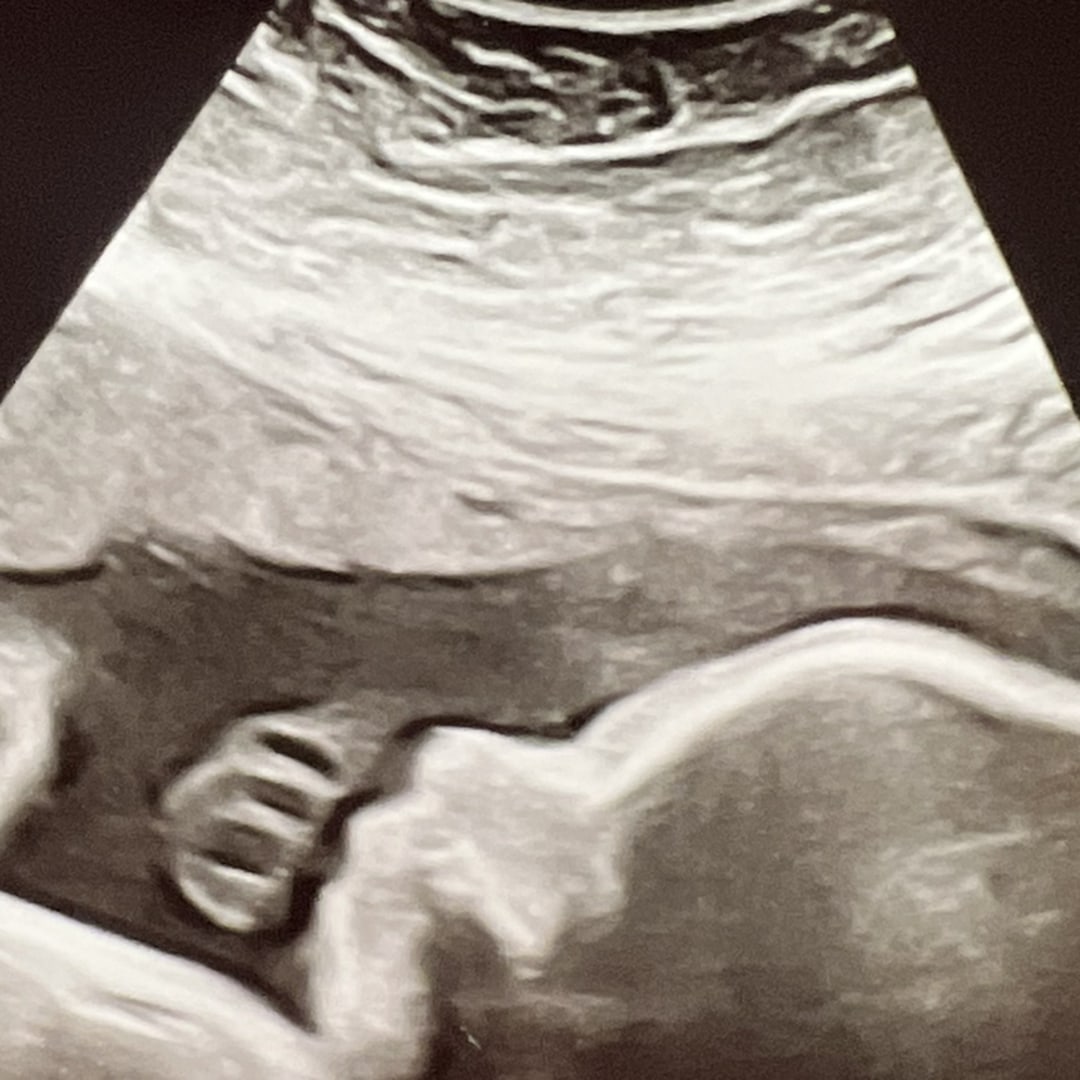 Photo shared by Kristie for their Babylist baby registry.