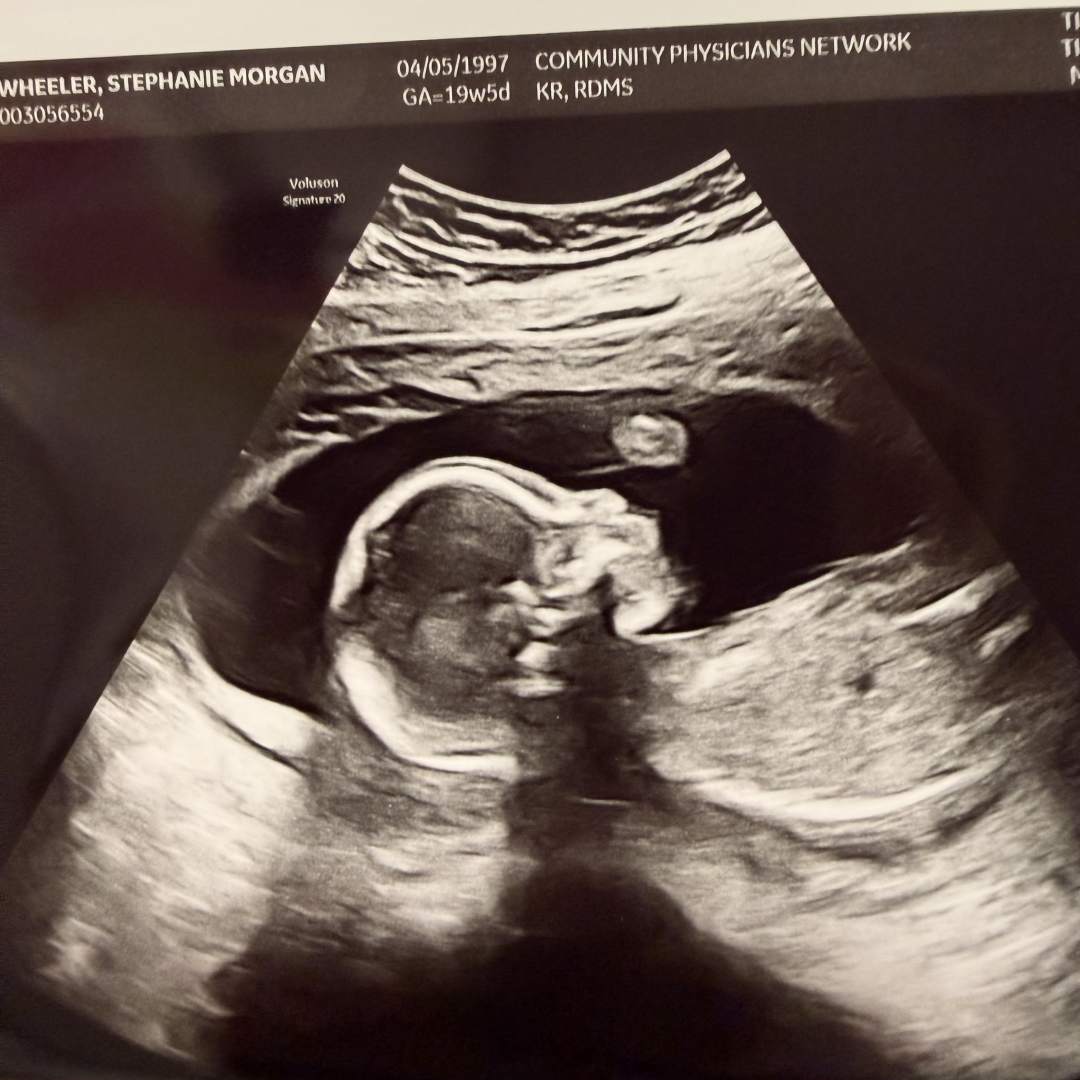 Photo shared by Stephanie for their Babylist baby registry.