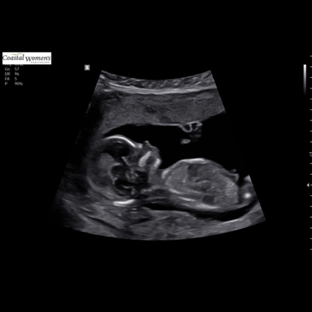 Photo shared by Cadence for their Babylist baby registry.