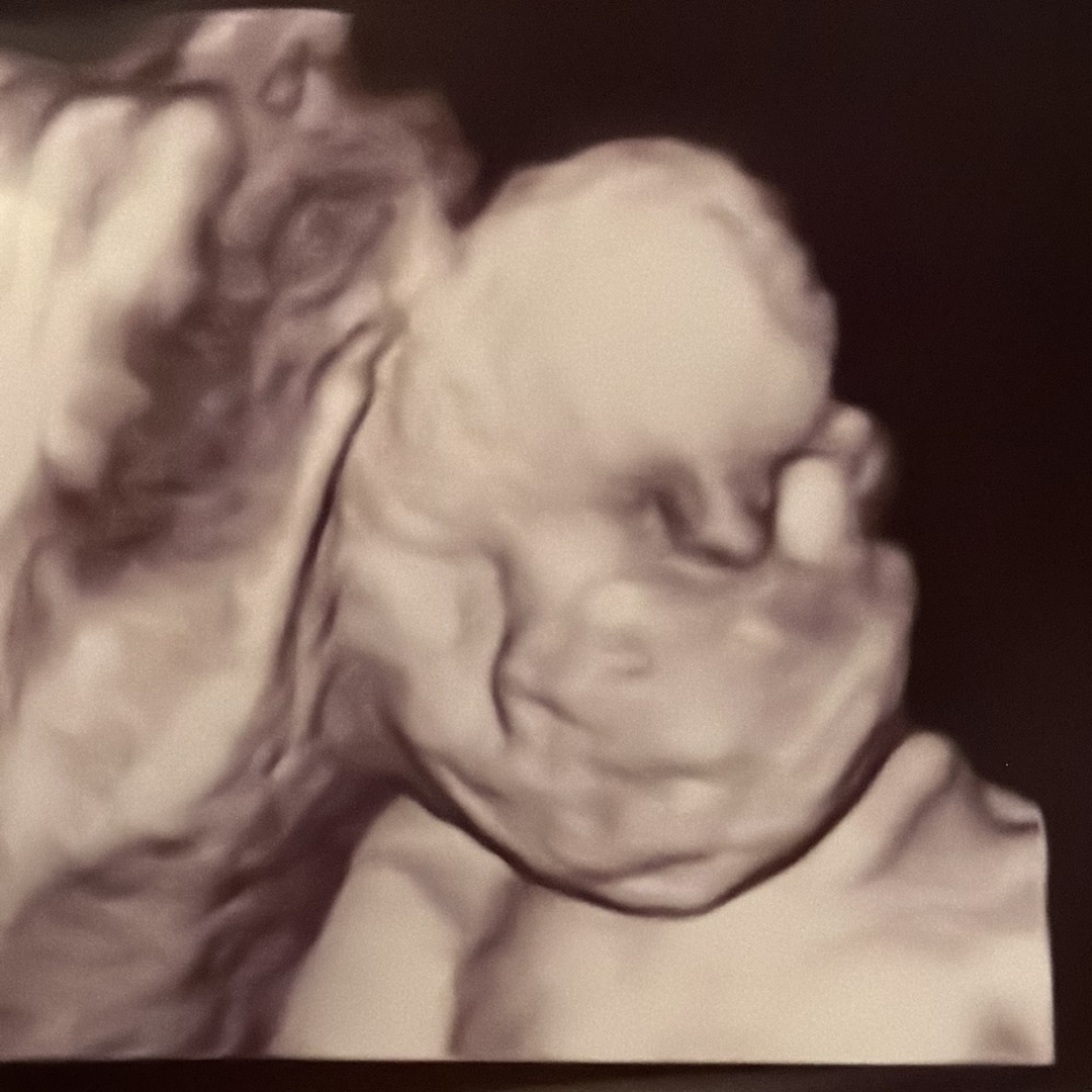 Photo shared by Claudia for their Babylist baby registry.