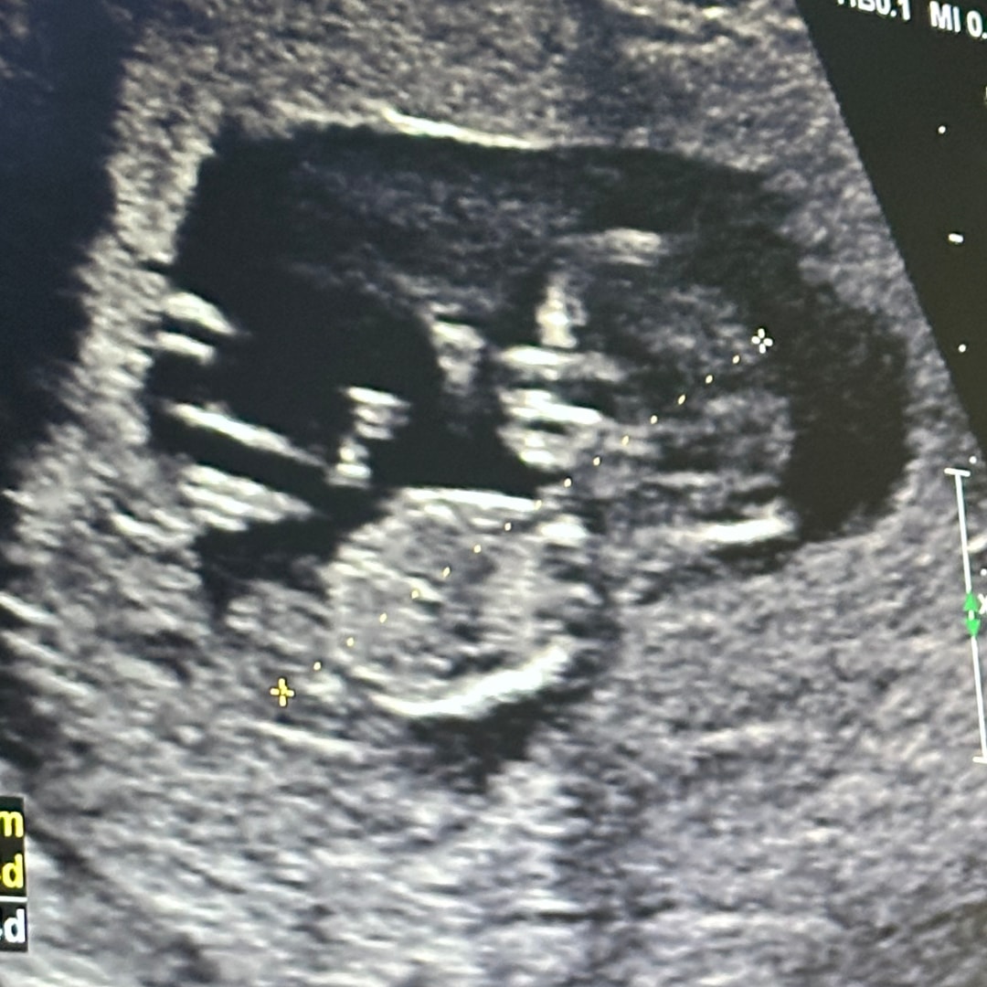 Photo shared by Camille for their Babylist baby registry.