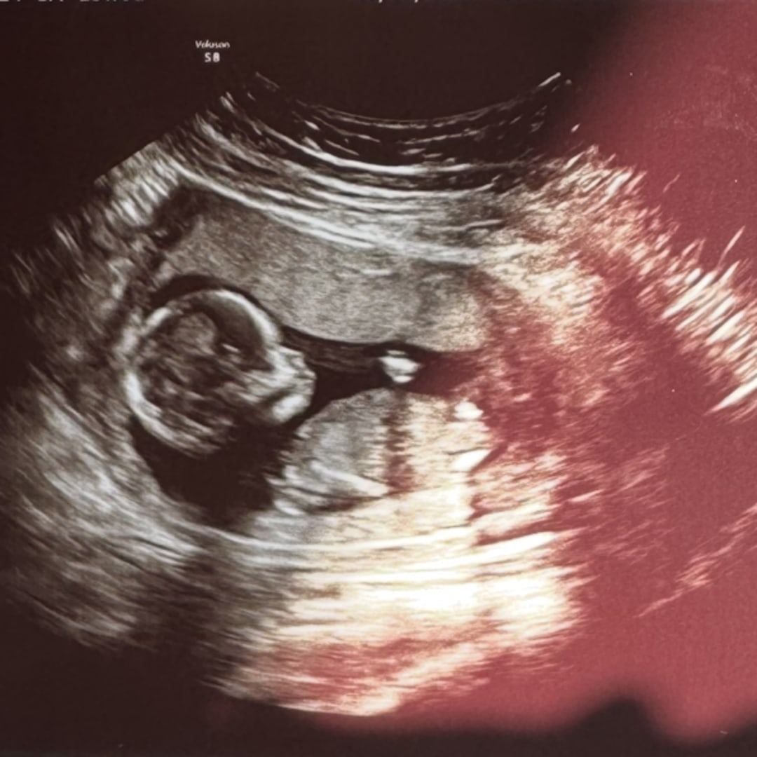 Photo shared by Amada for their Babylist baby registry.