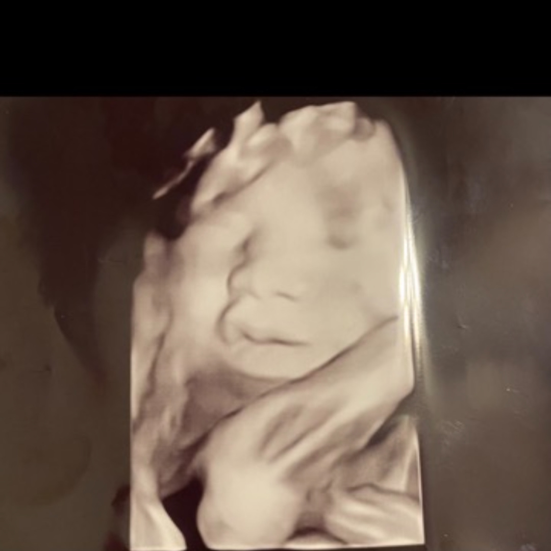 Photo shared by Ashlyn for their Babylist baby registry.