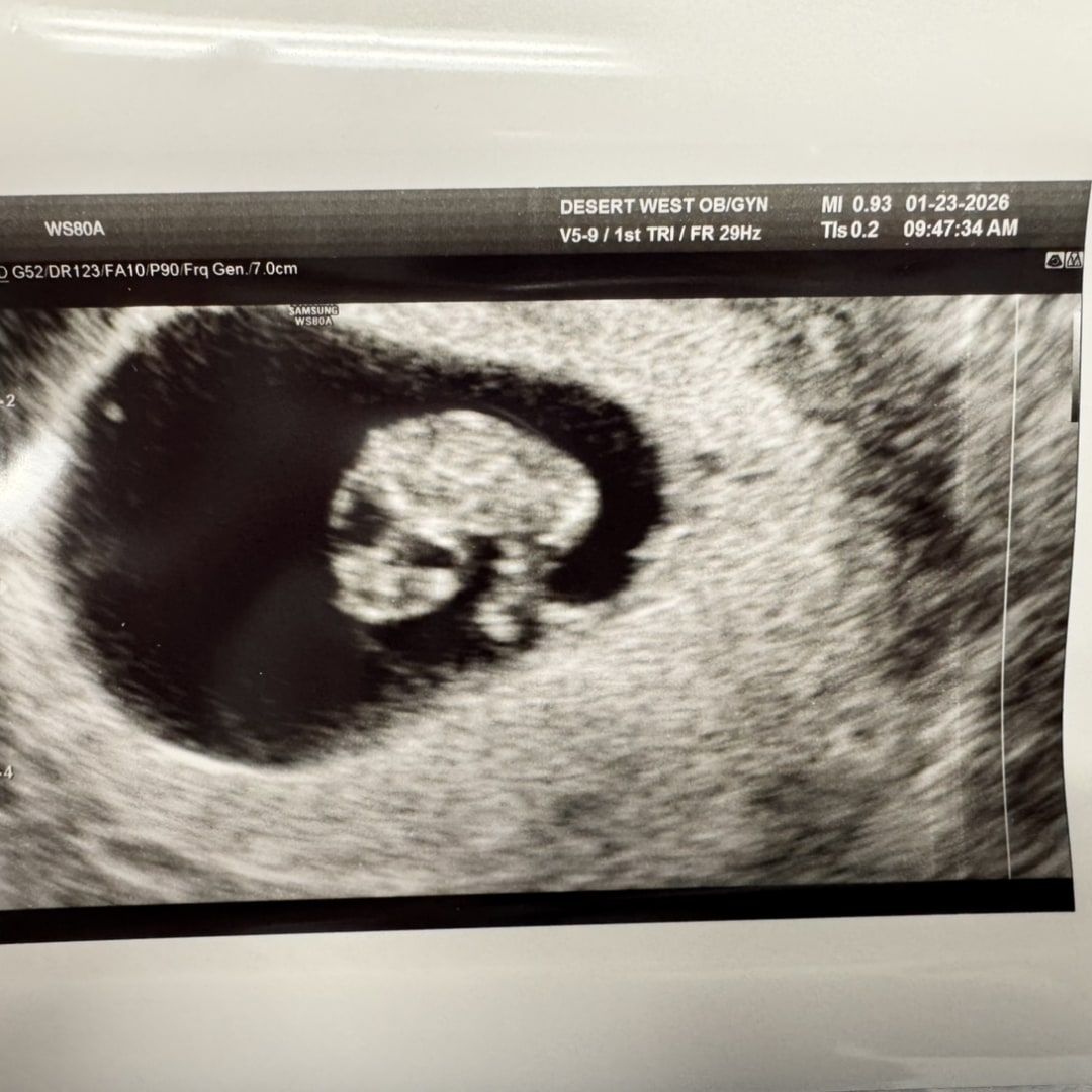 Photo shared by Alexis for their Babylist baby registry.