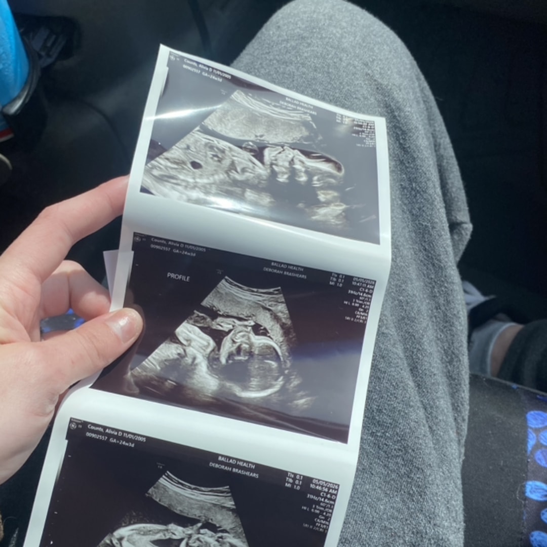 Photo shared by Alivia for their Babylist baby registry.