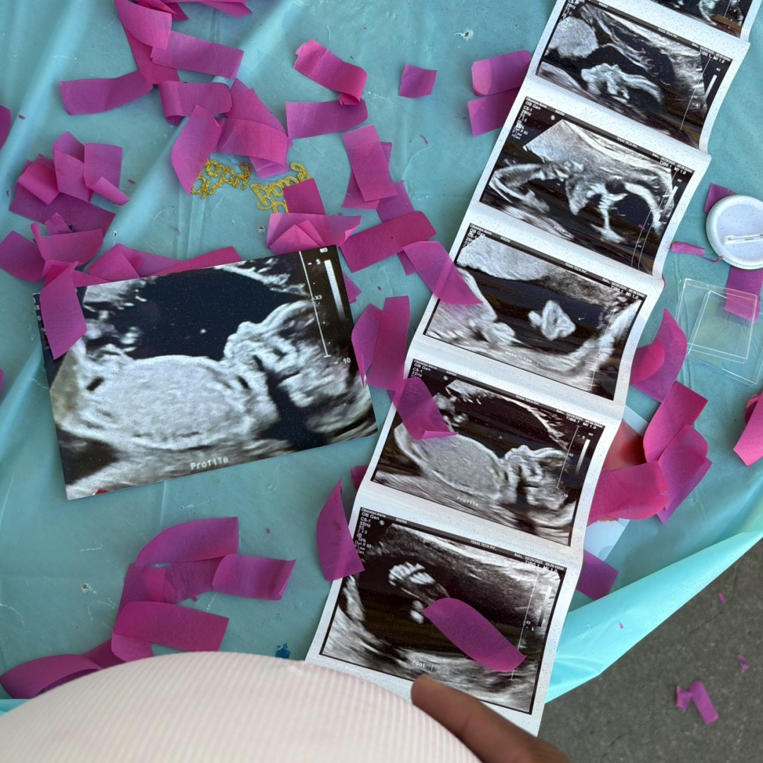 Photo shared by Alanis for their Babylist baby registry.