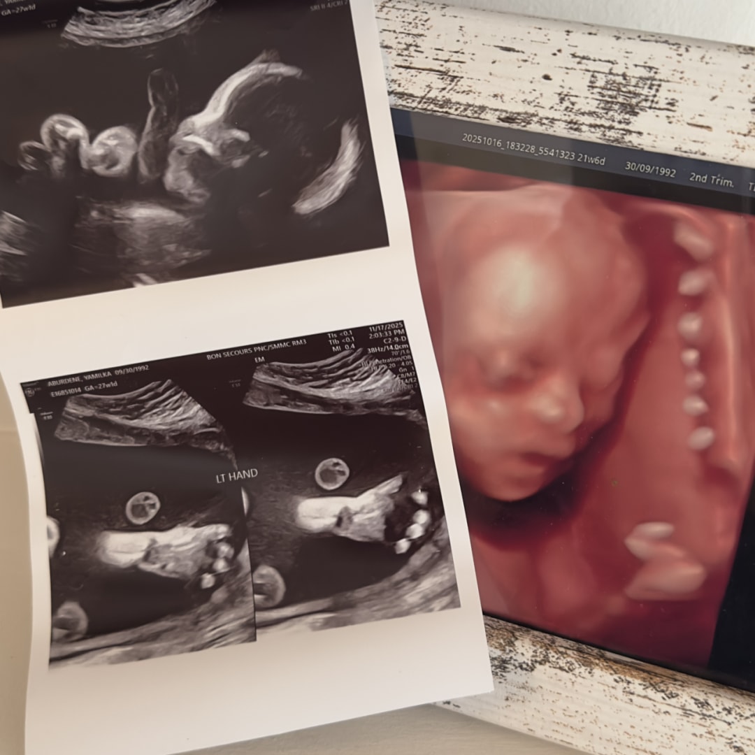 Photo shared by Yamilka for their Babylist baby registry.