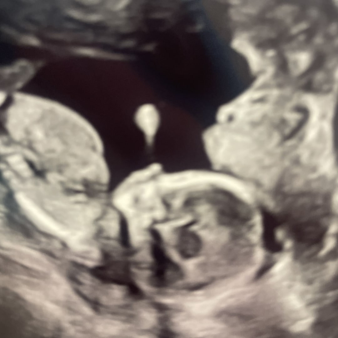 Photo shared by Christy for their Babylist baby registry.