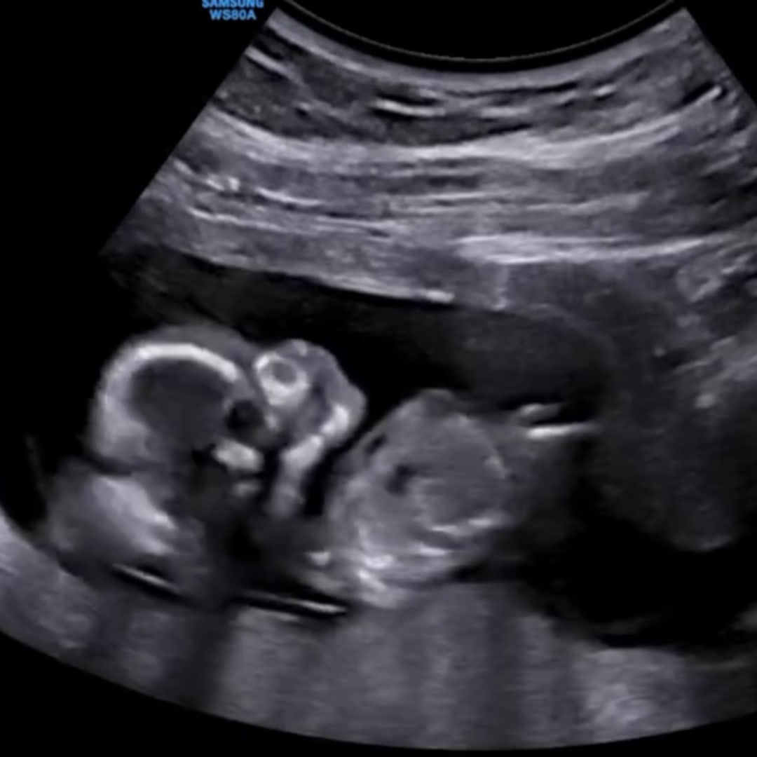 Photo shared by Emily for their Babylist baby registry.