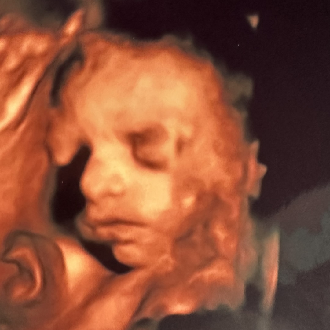 Photo shared by Caroline for their Babylist baby registry.