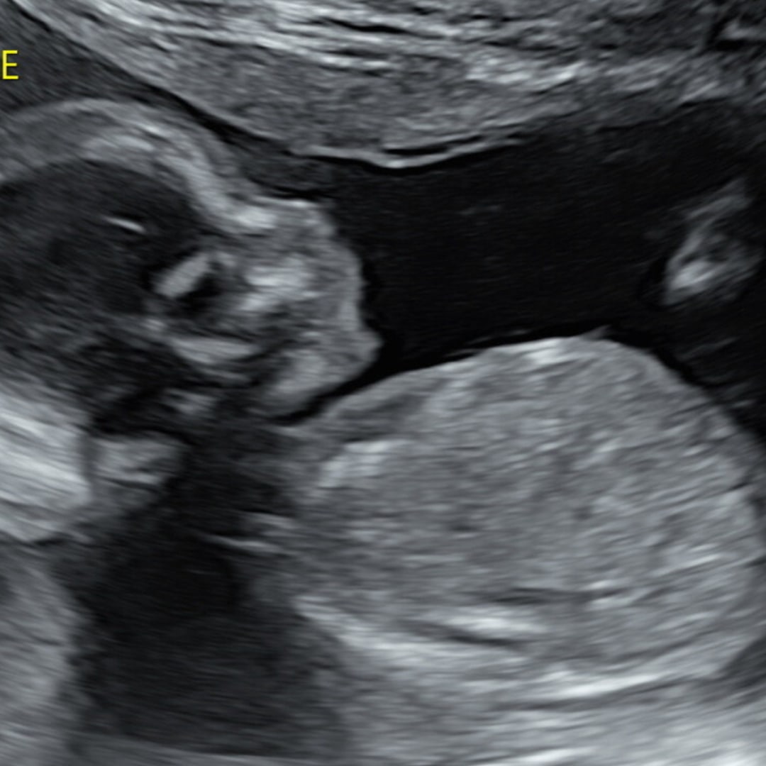 Photo shared by Rachel for their Babylist baby registry.