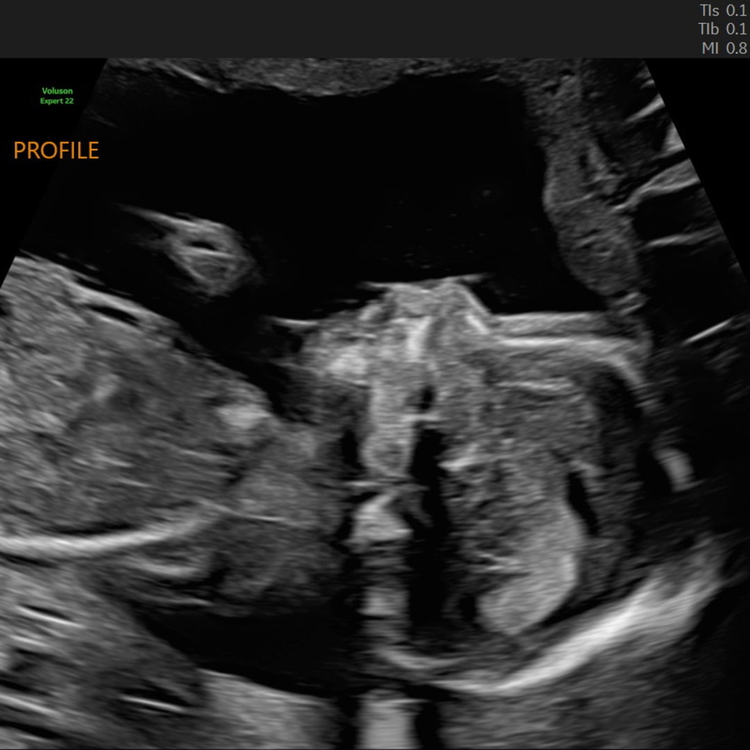 Photo shared by Brooke for their Babylist baby registry.