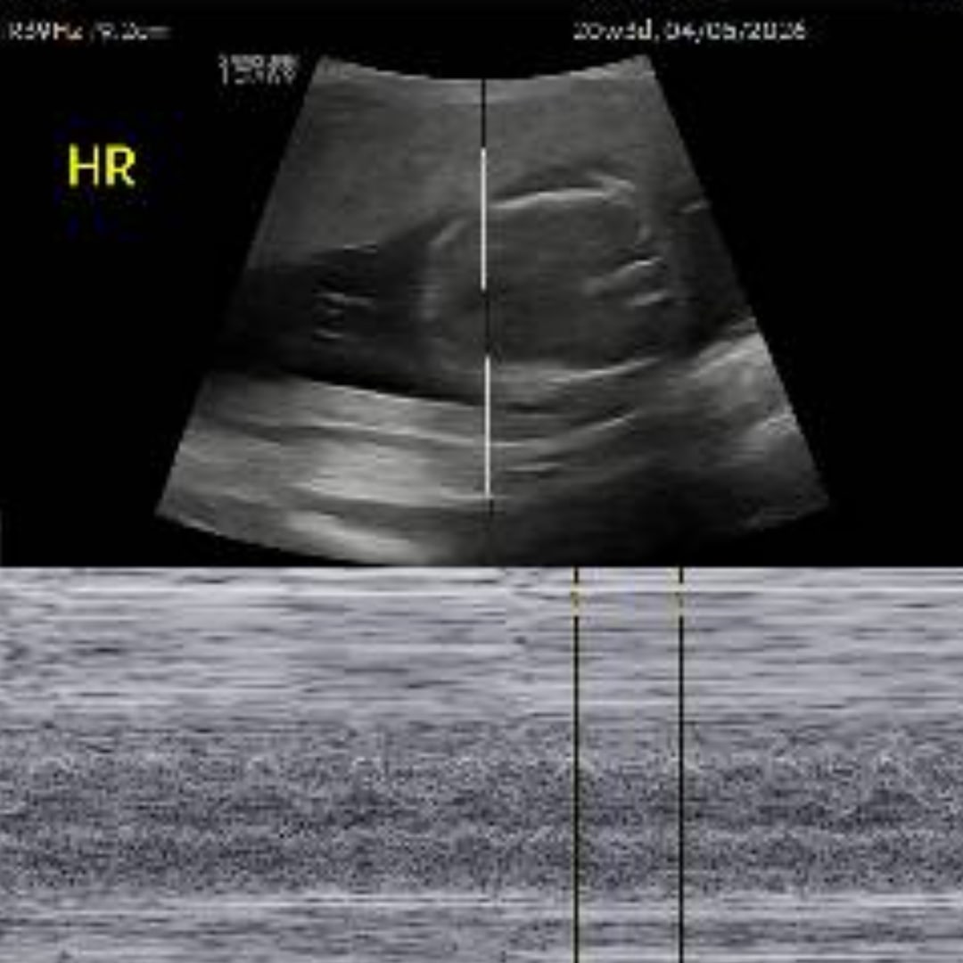 Photo shared by Alex for their Babylist baby registry.