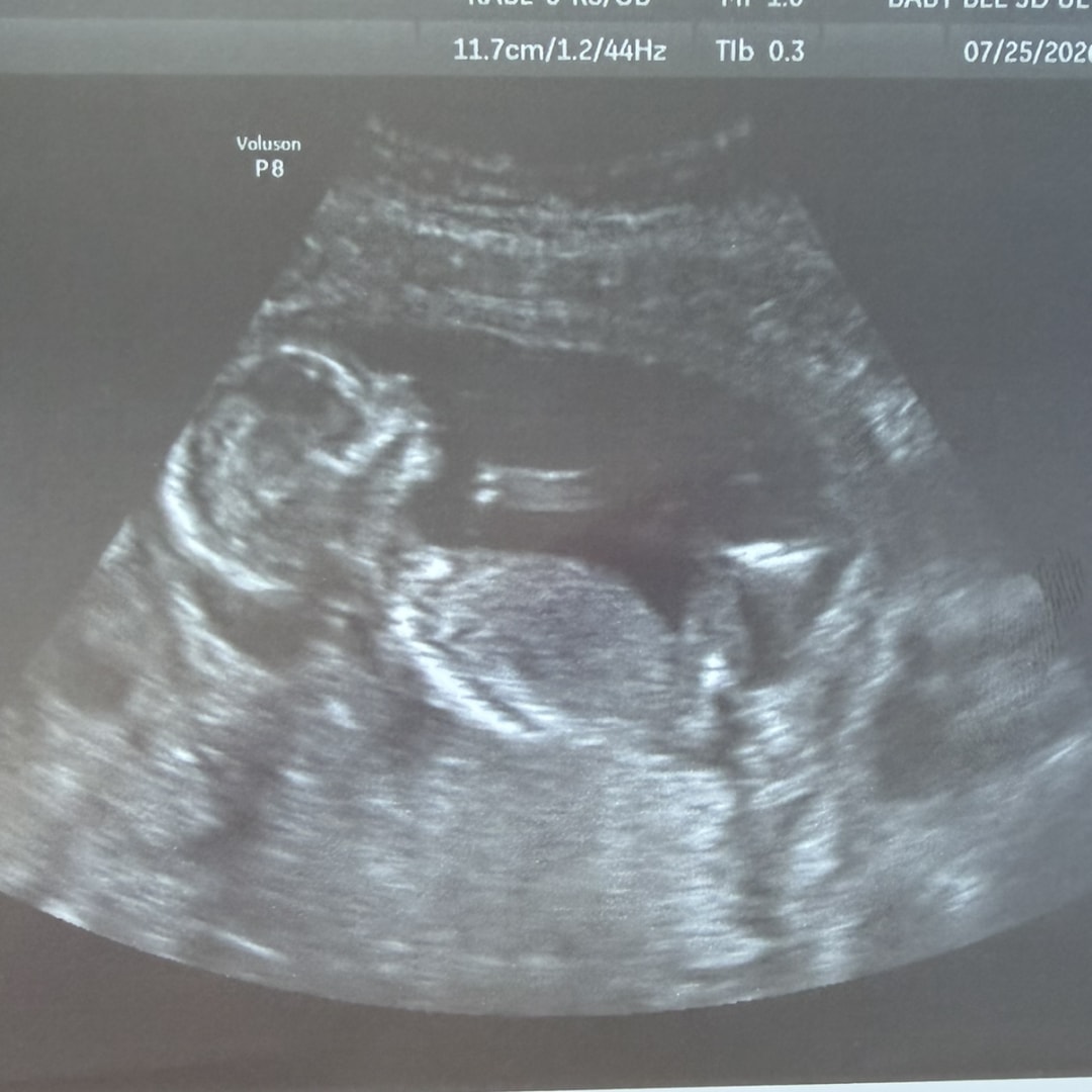 Photo shared by Gabrielle for their Babylist baby registry.