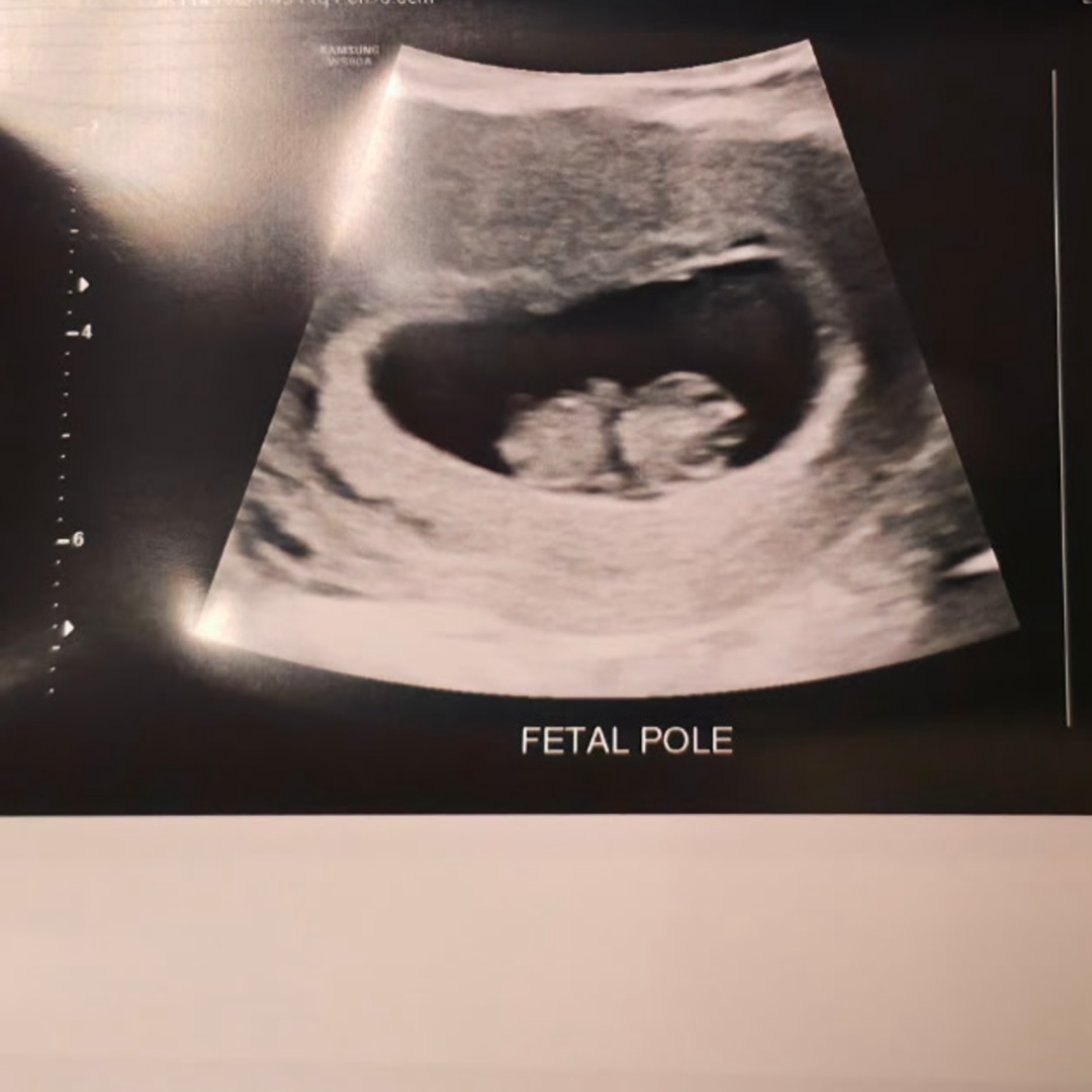 Photo shared by Yadira for their Babylist baby registry.
