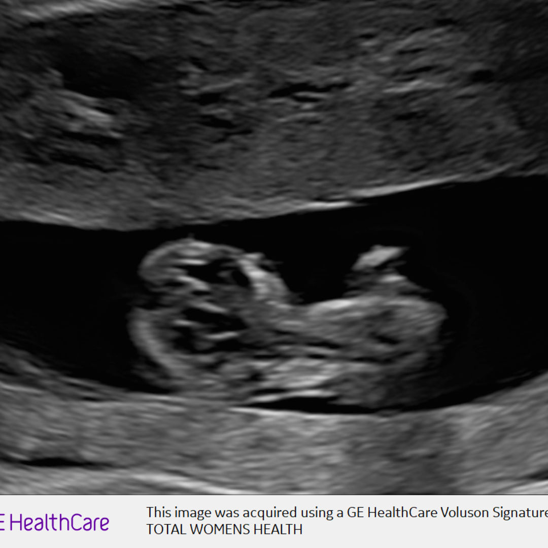 Photo shared by Charde for their Babylist baby registry.