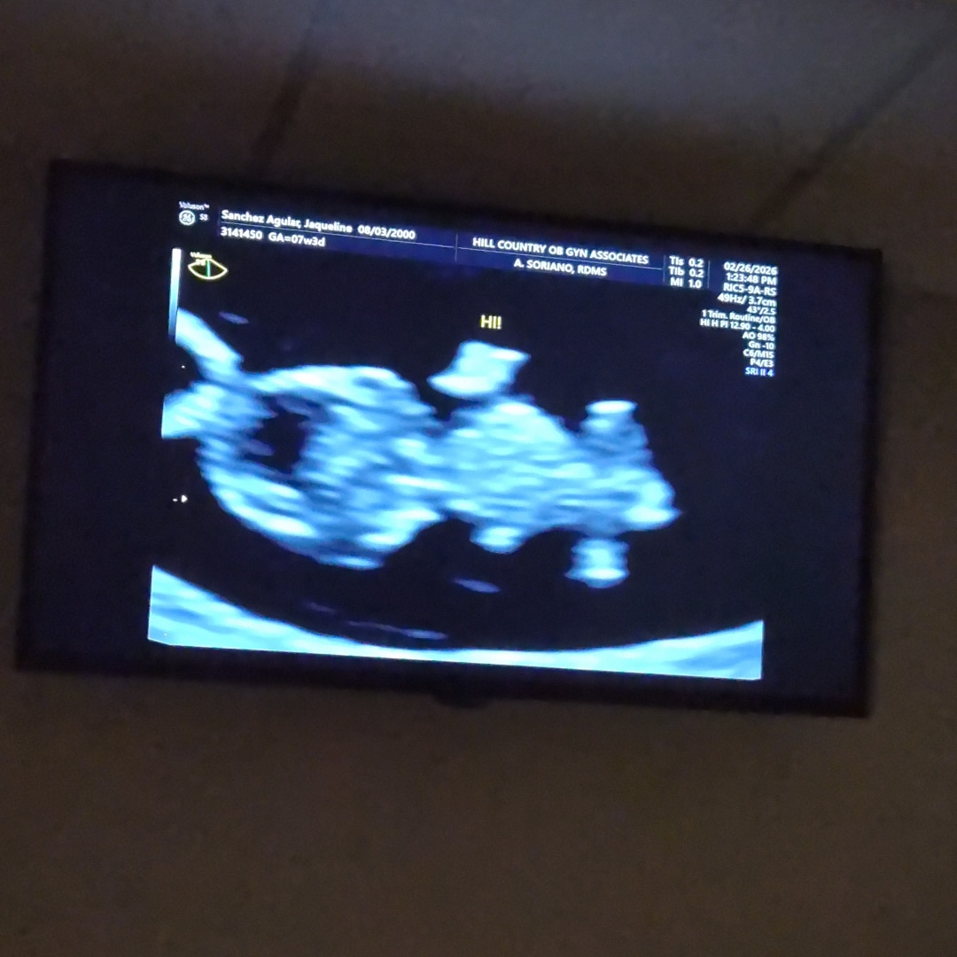 Photo shared by Jacky for their Babylist baby registry.