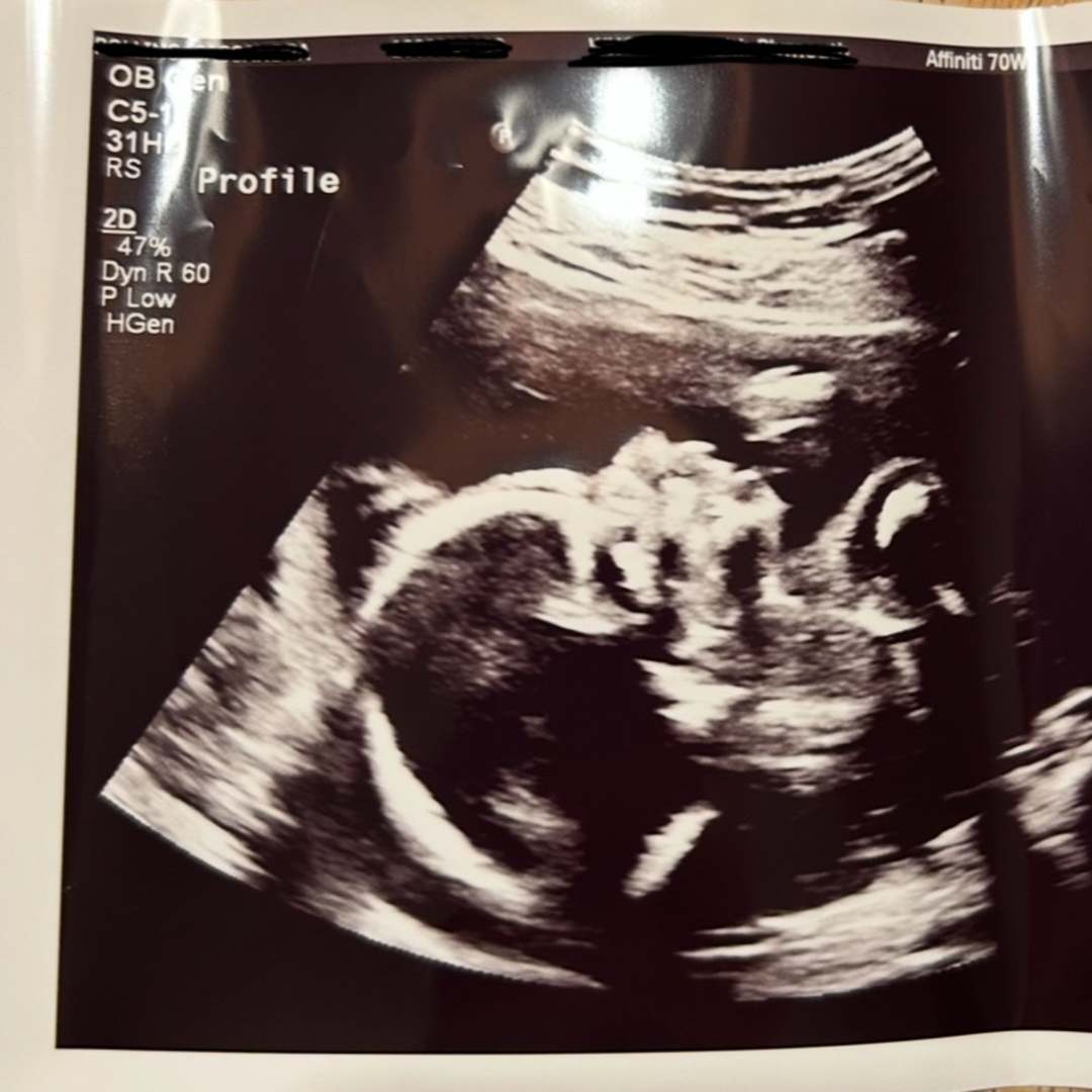 Photo shared by Cassie & Caleb for their Babylist baby registry.