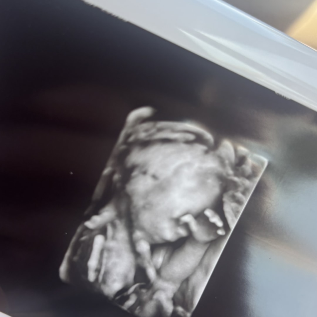 Photo shared by Olivia for their Babylist baby registry.