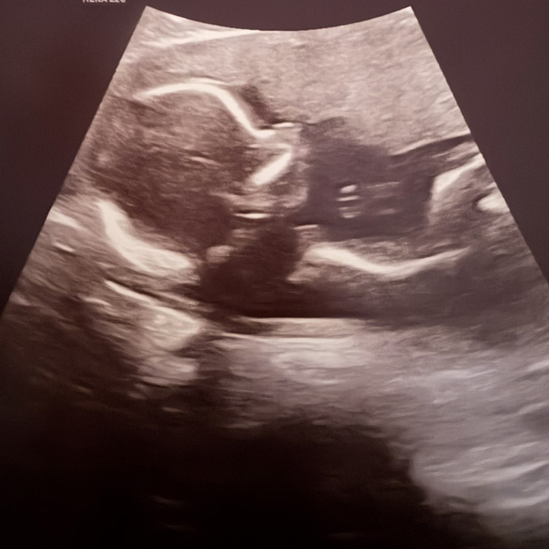 Photo shared by Arianna for their Babylist baby registry.