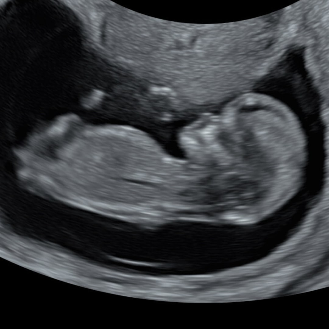 Photo shared by Salena for their Babylist baby registry.