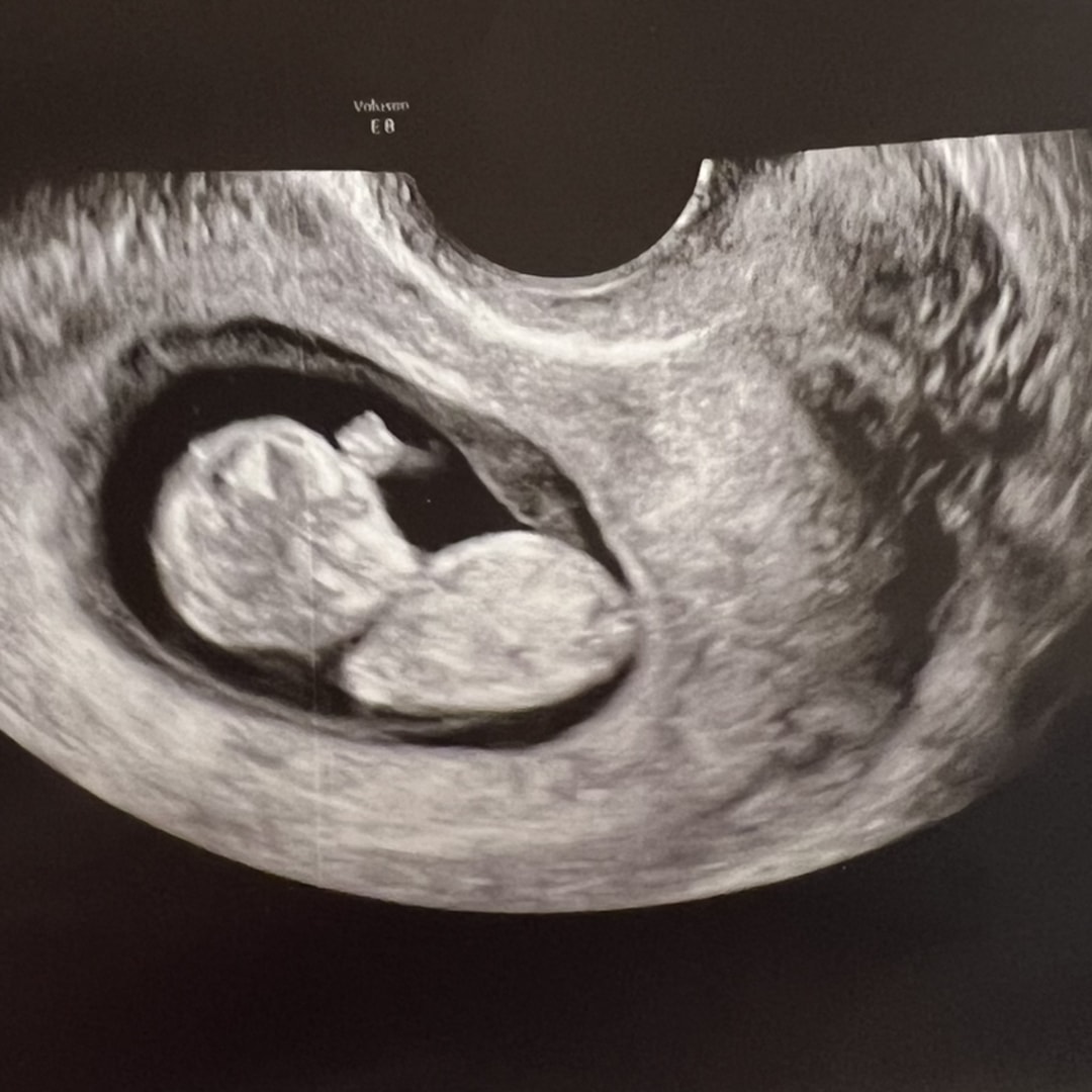 Photo shared by Lauren for their Babylist baby registry.