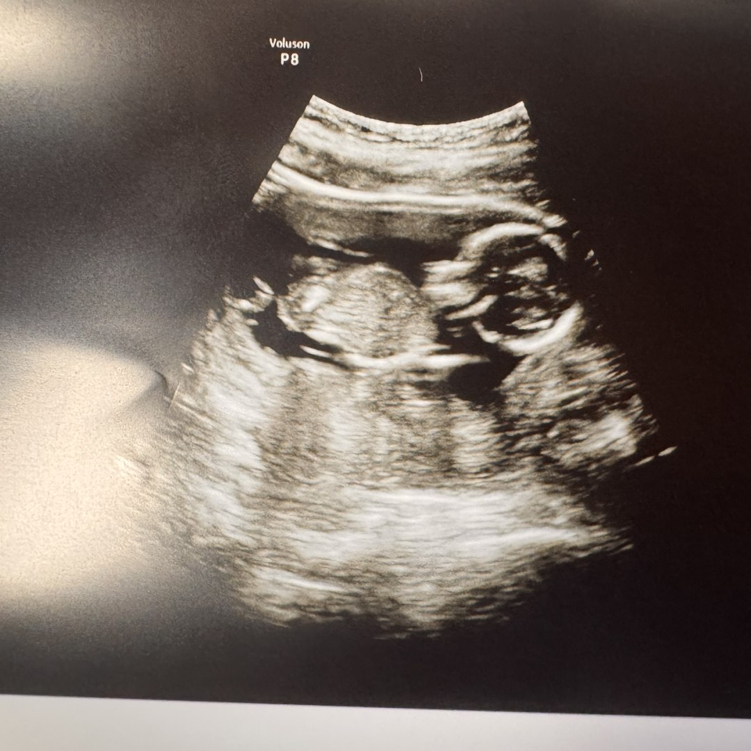 Photo shared by Krista for their Babylist baby registry.