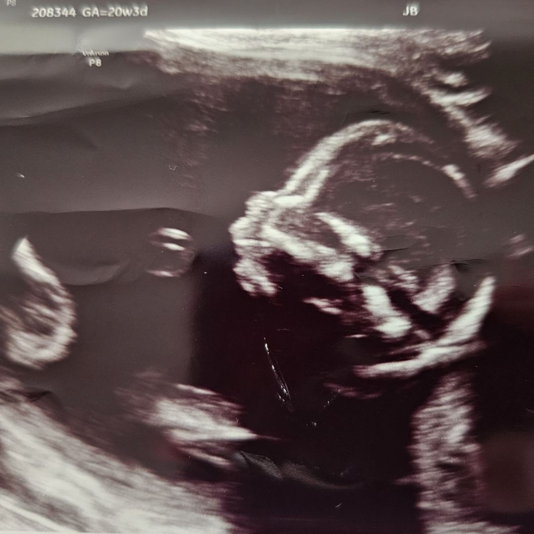 Photo shared by Joanna for their Babylist baby registry.