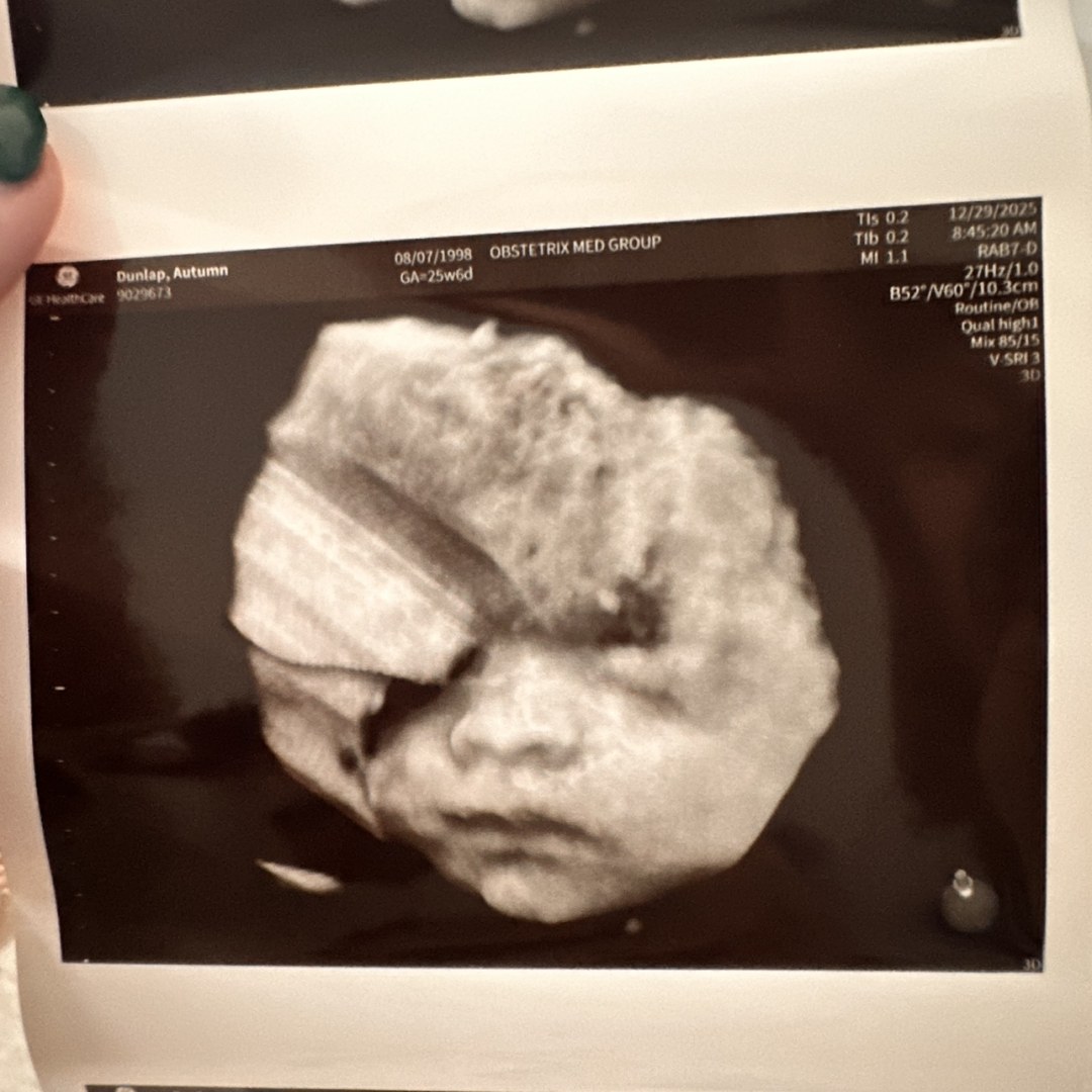 Photo shared by Autumn for their Babylist baby registry.