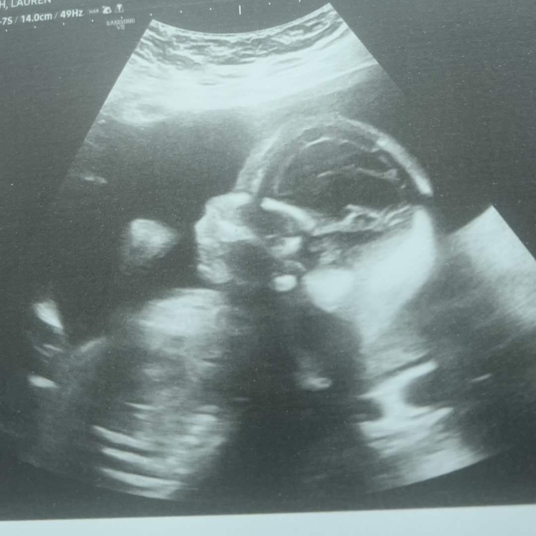 Photo shared by Lauren for their Babylist baby registry.
